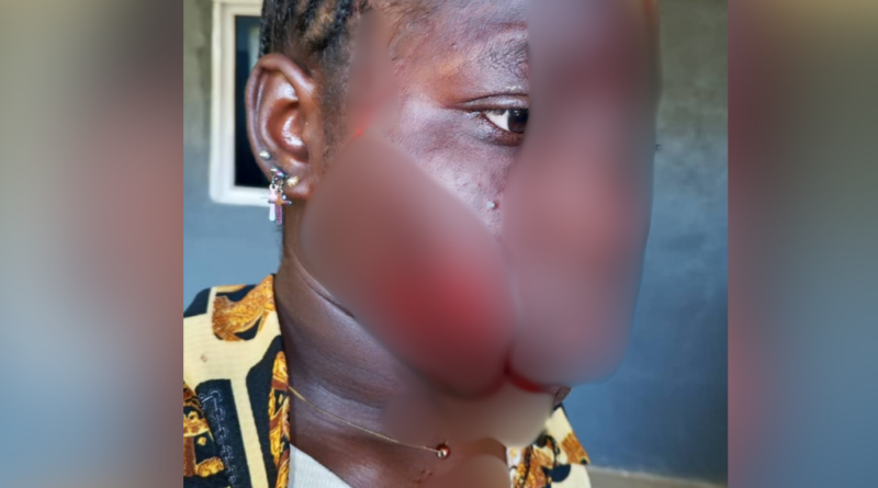 Taraba woman disfigures teenage girl’s face because husband likes her over