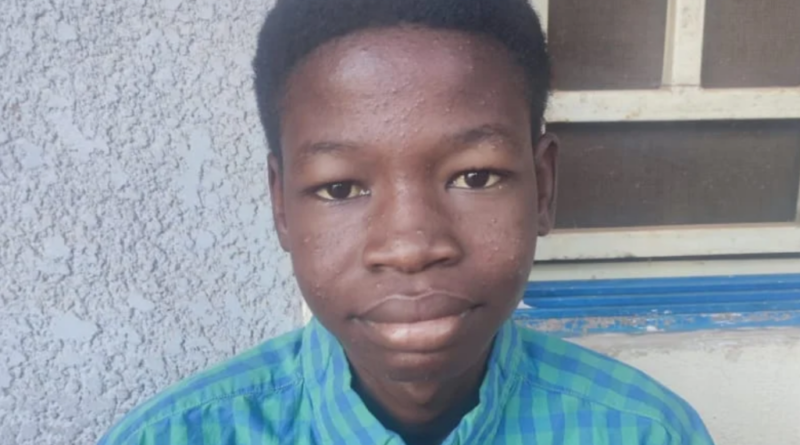 Unusual story of Gombe varsity student who lives on liquids for 21 years