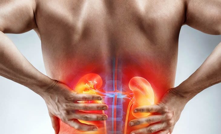 Why 1 in 3 early-stage kidney cancer patients show no symptoms