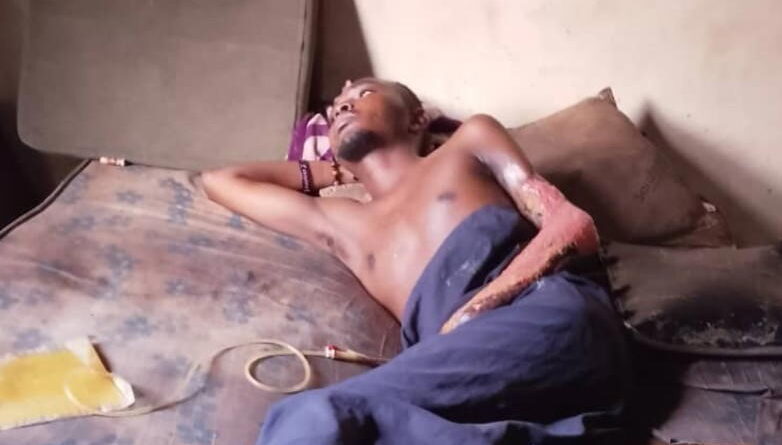 Mother seeks help to raise N14.5m for injured son’s surgery
