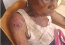 At 90, Abia widow fights for life amid repeated assault by brother’s wife, kids