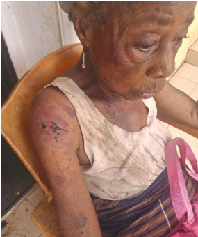 At 90, Abia widow fights for life amid repeated assault by brother’s wife, kids