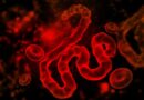 Ebola