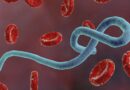 Ebola
