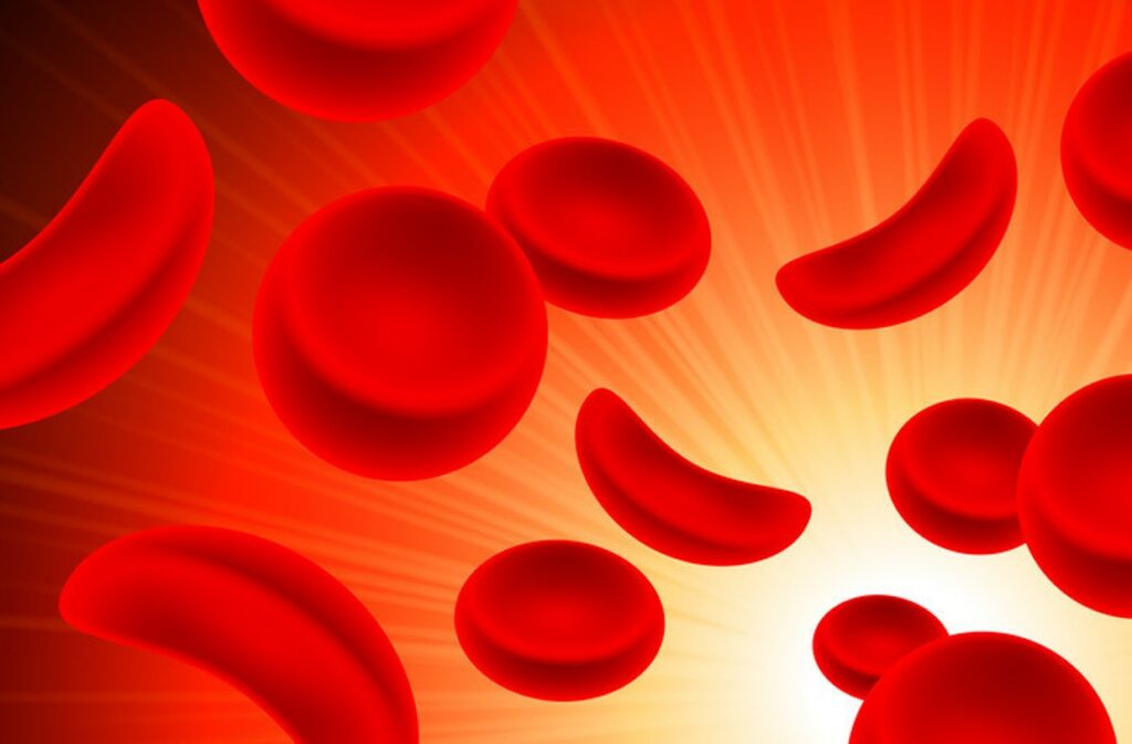 Sickle Cell warriors demand better care, hope, cure