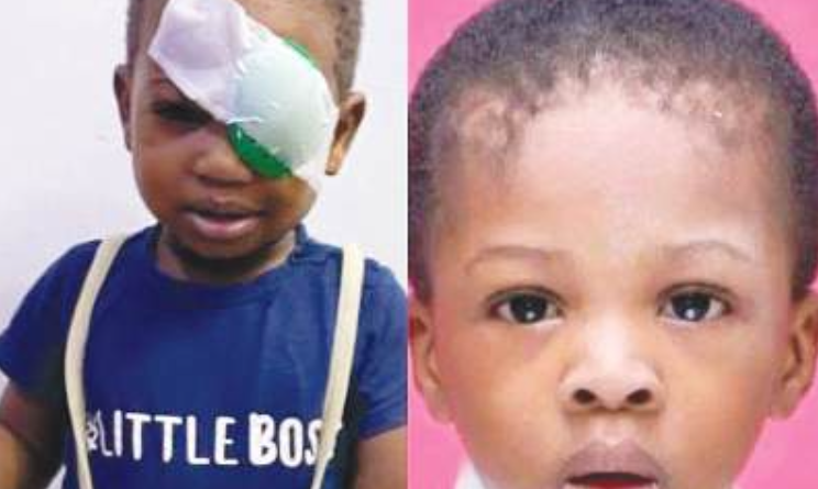 NDLEA shooting: Parents of slain toddler seek compensation as survivor brother, 4, loses eye