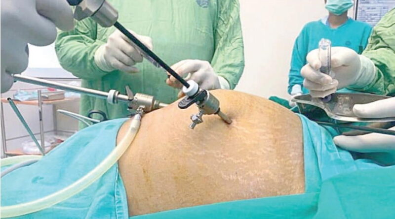 Beyond Surgery: Can nutrition and lifestyle help prevent uterine fibroids?
