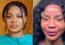 Uche Ogbodo reveals ‘new face’ after non-surgical procedure