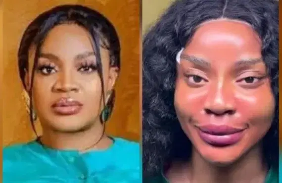 Uche Ogbodo reveals ‘new face’ after non-surgical procedure