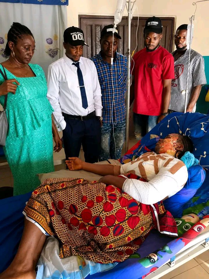 Hot water attack: University student hospitalised with severe burns in Benue