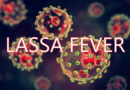 lassa fever