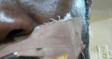 Imansuaghon, ADC Candidate, Okonofua Escape Death In Gun Attack 