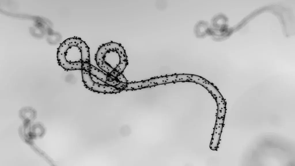 Ebola: 5 things to know about Bundibugyo Strain as Nigeria confirms first case