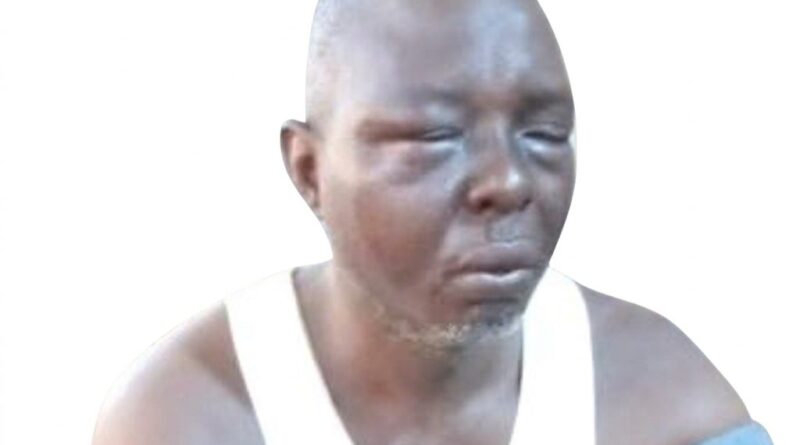 Adeda after the fatal assault